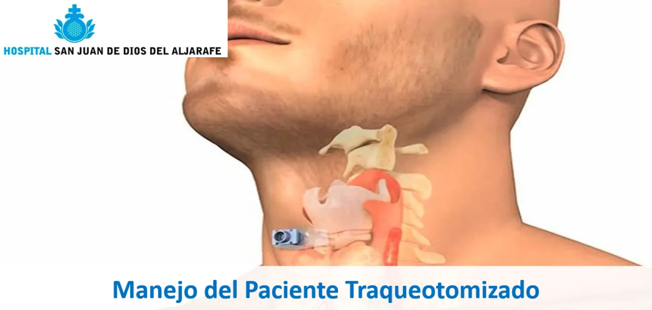 Manejo del paciente Traqueotomizado