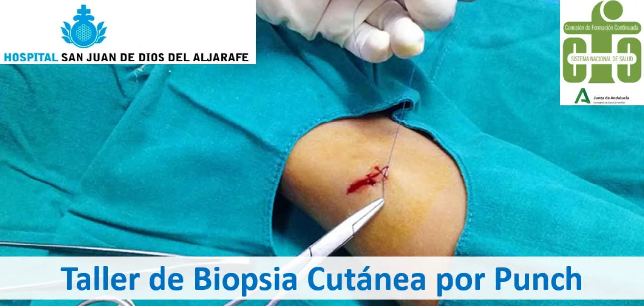 Biopsia Cutánea por Punch